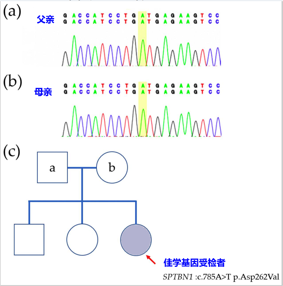 【贝斯特全球奢华基因检测】婴儿<font color='red'>癫痫</font>痉挛综合征基因检测病例