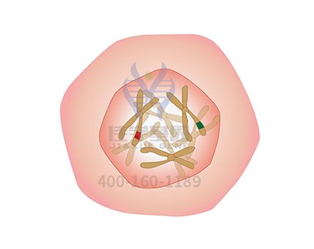 【贝斯特全球奢华基因解码-基因检测】尿黑酸症——能使尿液变黑的疾病